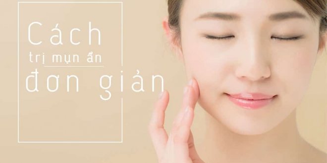 Cach Tri Mun An 660x330